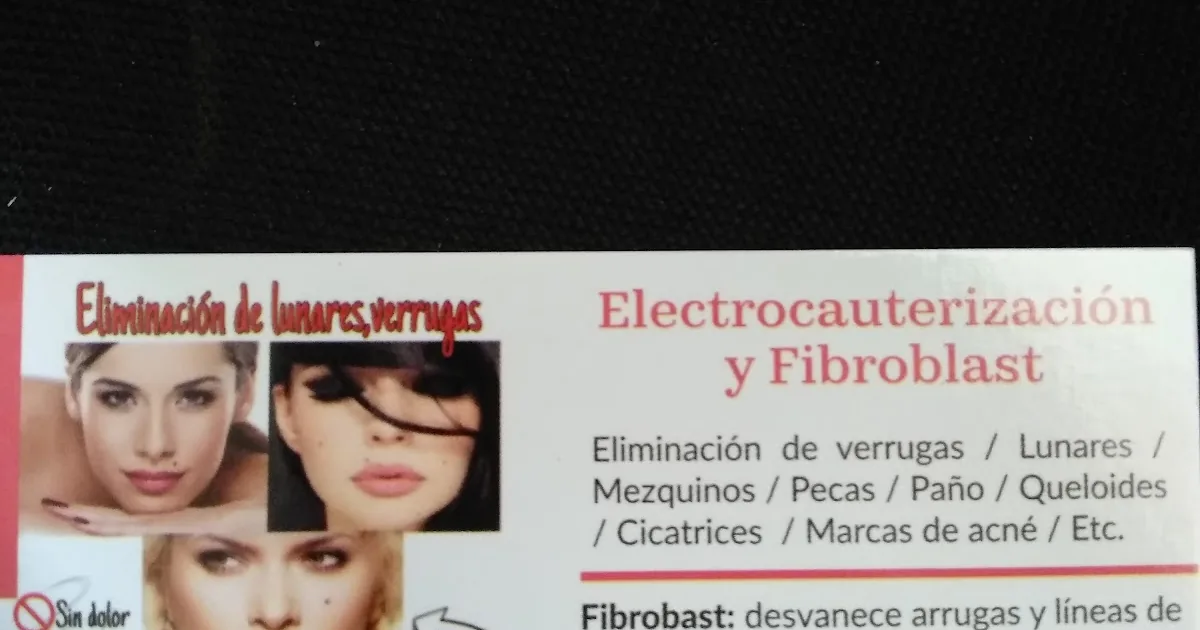 Verrugas yadhira salazar