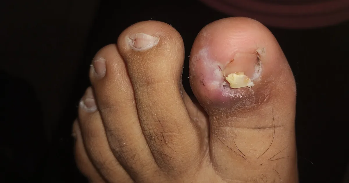 Pedicurista