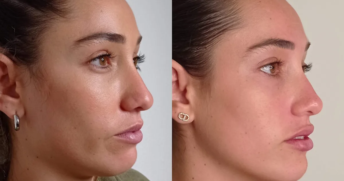 Tretze Beauty Sculpting