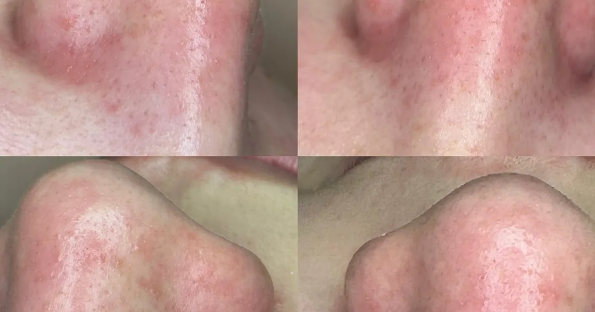 Erandy spa