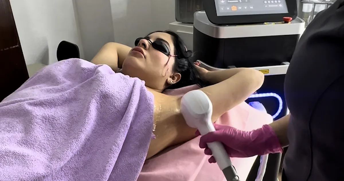 dermapel -Clínica de depilación laser cuatri Diodo en Frio