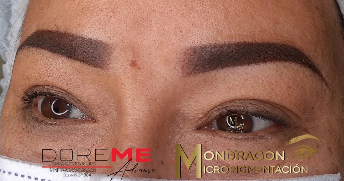Micropigmentacion retiro de tatuajes lunares verrugas laser faciales acupuntura china imanes en San Cristóbal Chiapas