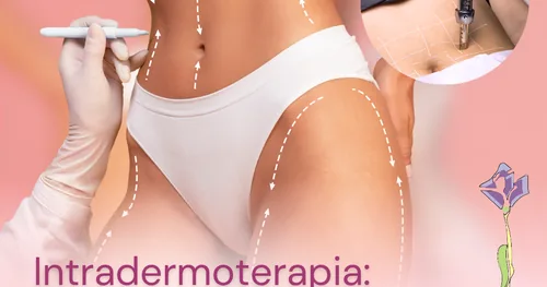 Albarella Spa, negocios en Xalapa, Veracruz